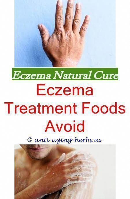 severe eczema eczema getting worse
