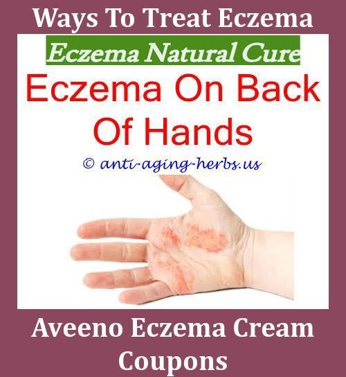 Severe Eczema Orange Naturals Eczema Reliefeczema rash relief eczema ...