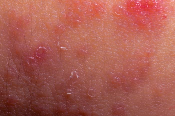 Skin diseases: List of common conditions and symptoms