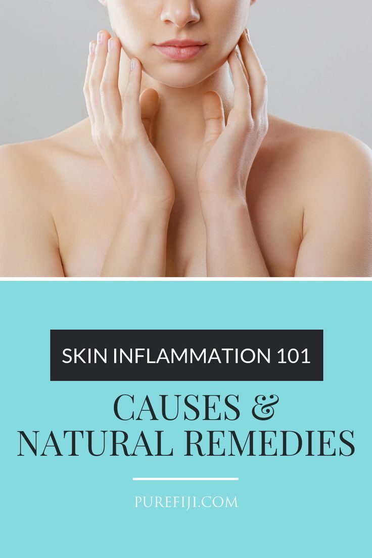 Skin Inflammation 101: Causes and Remedies in 2020