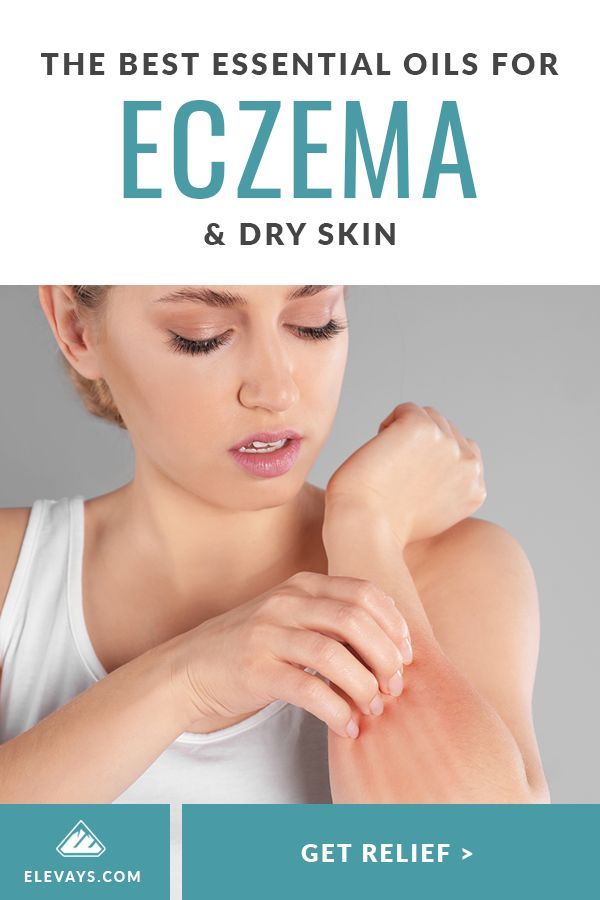 The Best Essential Oil for Eczema and Dry Skin