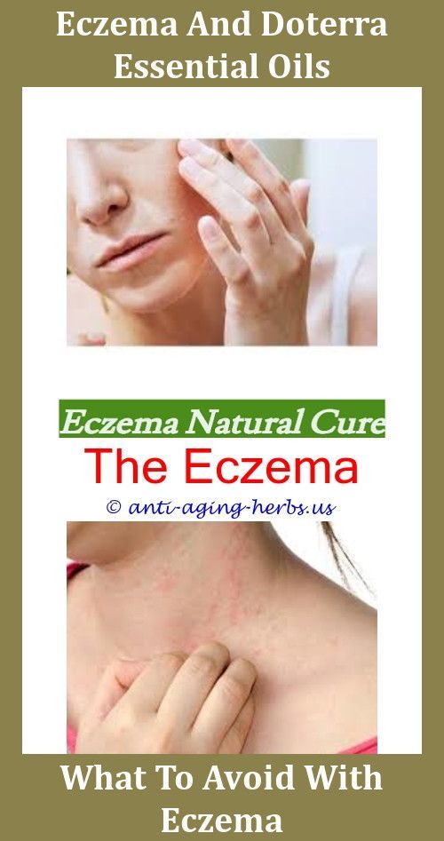 The Eczema Diet Karen Fischer,kirk castile soap for eczema ...