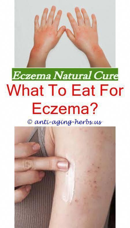 The reddened, itchy skin of eczema can be very uncomfortable ...