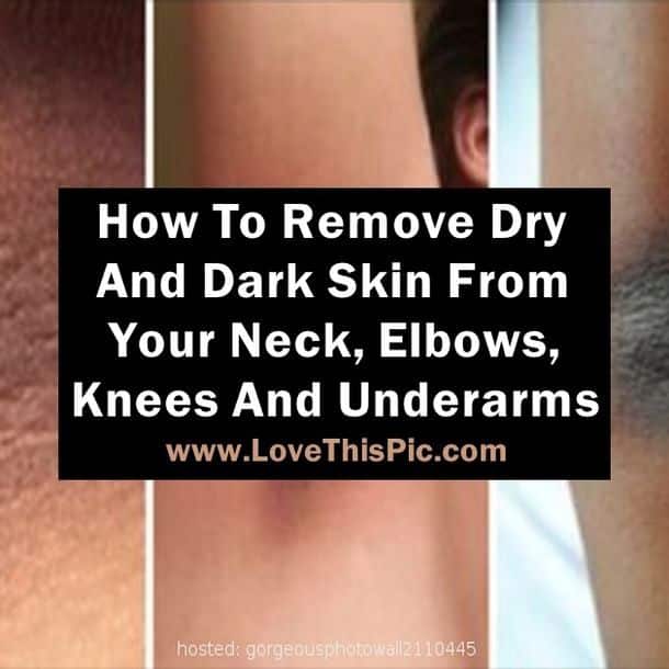 This Is How To Naturally Remove Dry And Dark Skin From Your Neck ...