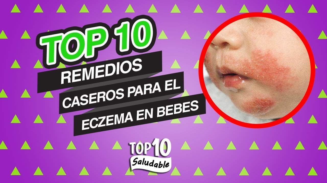 TOP 10 Remedios Caseros para el Eczema en Bebes
