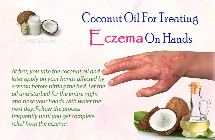 Top 10 Ways How To Use Coconut Oil For Eczema Treatment