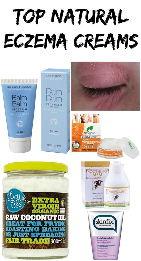 Top 5 Natural Eczema Creams For Sensitive Skin.