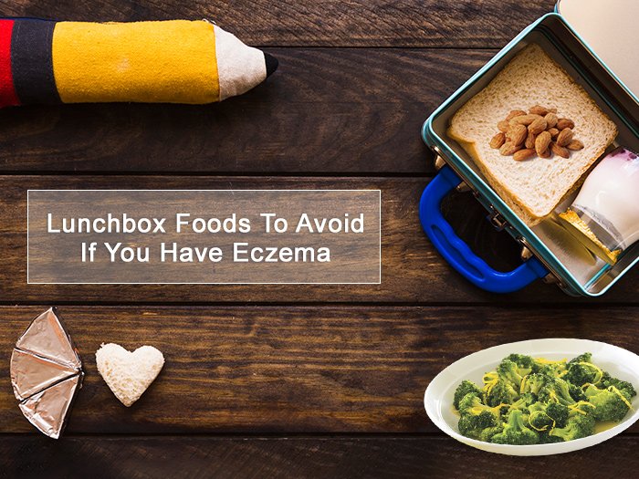 Top 8 Lunchbox Foods To Avoid If You Have Eczema