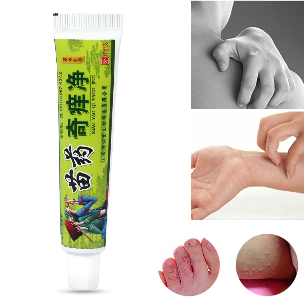 TOPINCN Miao Medicine Herbal Antibacterial Skin Itch Psoriasis Allergy ...