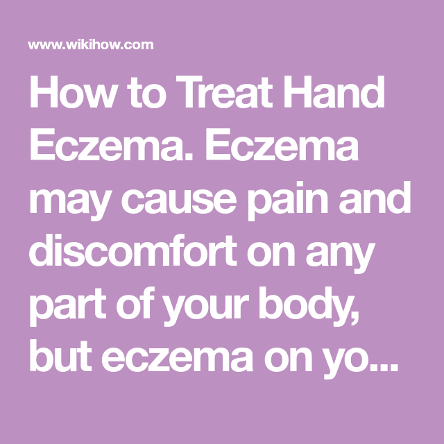 Treat Hand Eczema