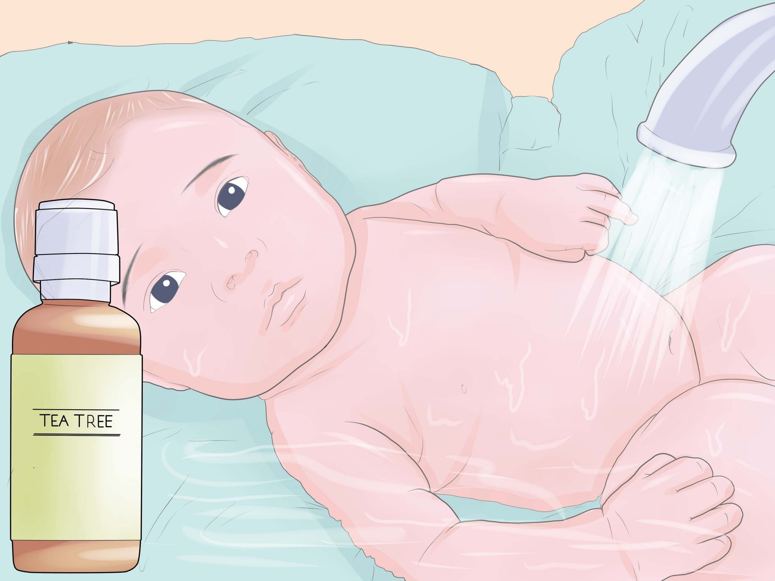 Treat Infant Eczema Naturally
