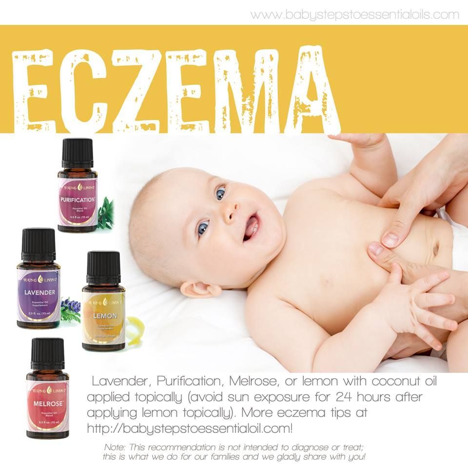 Treating eczema in children using essential oils. CONTACT ...