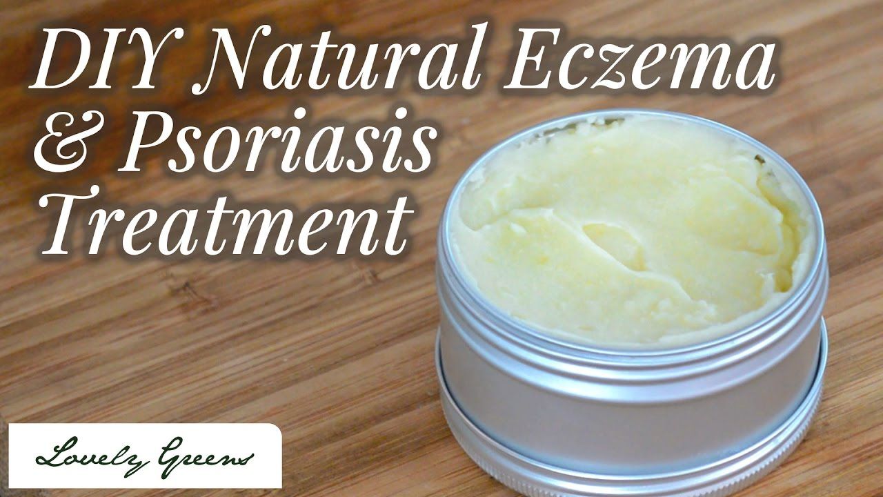 Tutorial for making a Natural Healing Cream for Eczema and ...