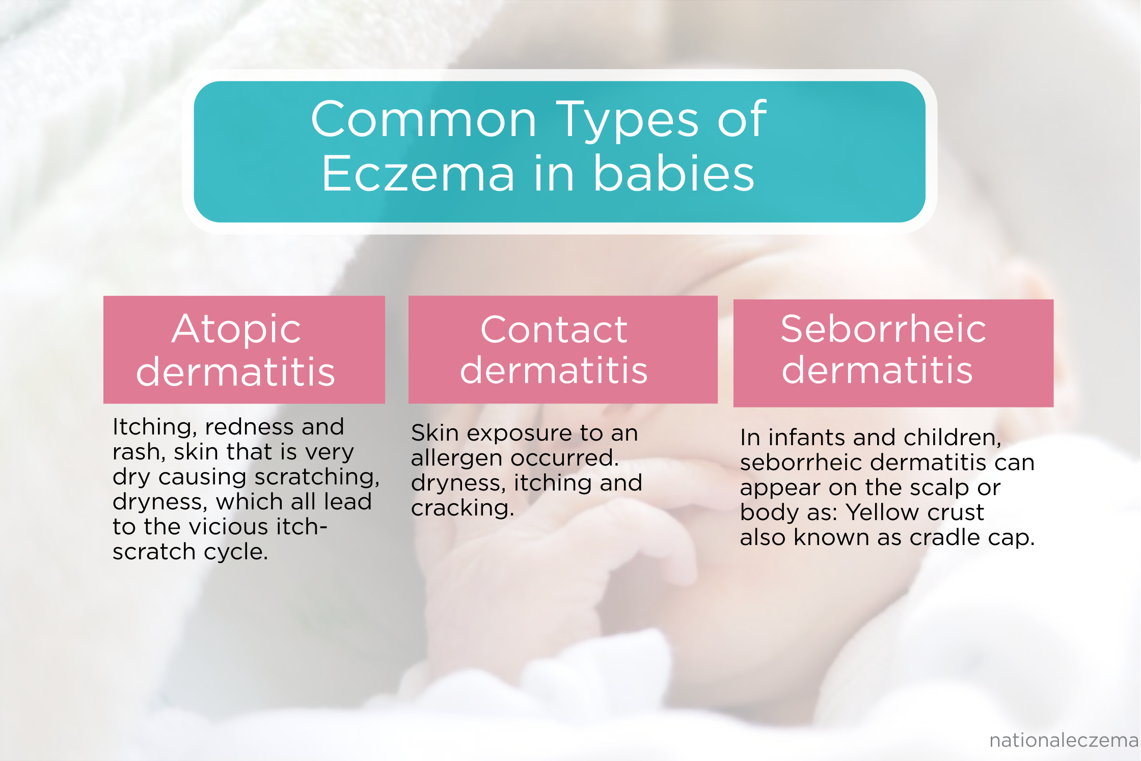 types of eczema in babies
