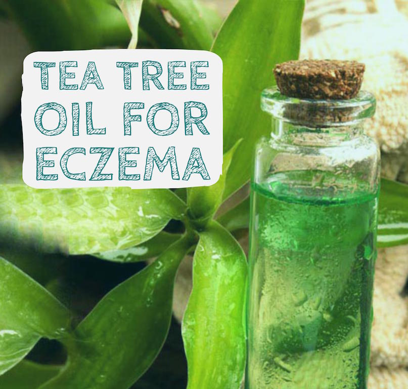 What Are The Best Essential Oils For Eczema Care?
