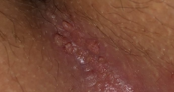 What are these bumps?!