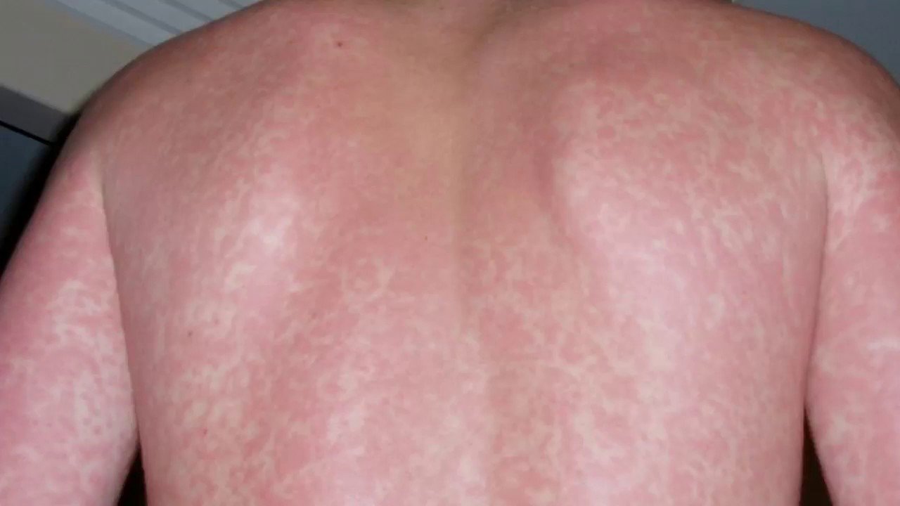 What Can Cause Itchy Skin All Over The Body