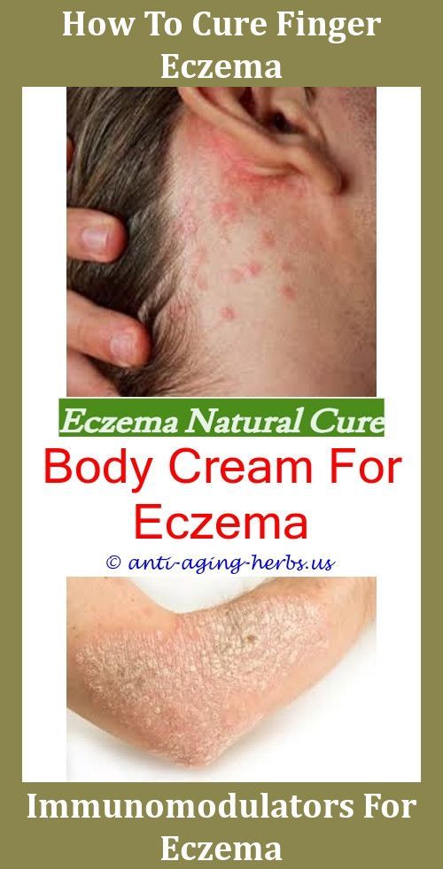 What Causes Eczema To Itch Eczema Flare Up The Best Way To Treat Eczema ...