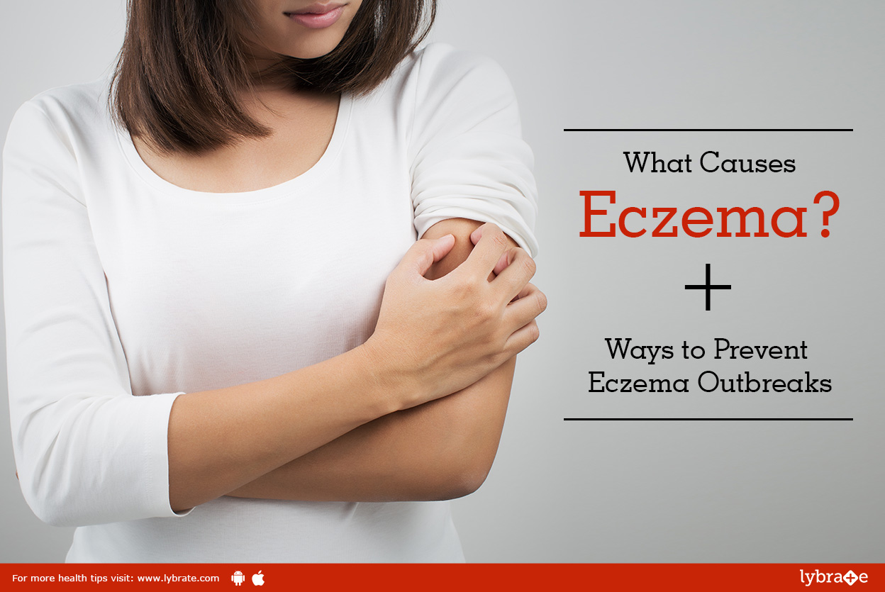 What Causes Eczema? Ways to Prevent Eczema Outbreaks