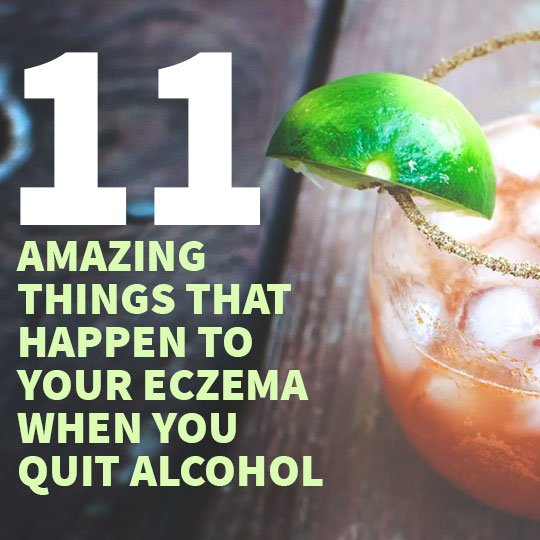 What happens to eczema when you quit alcohol?