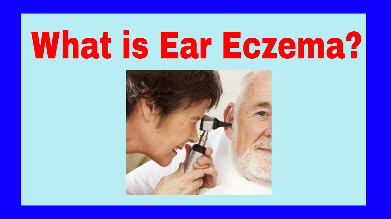 What is Ear Eczema