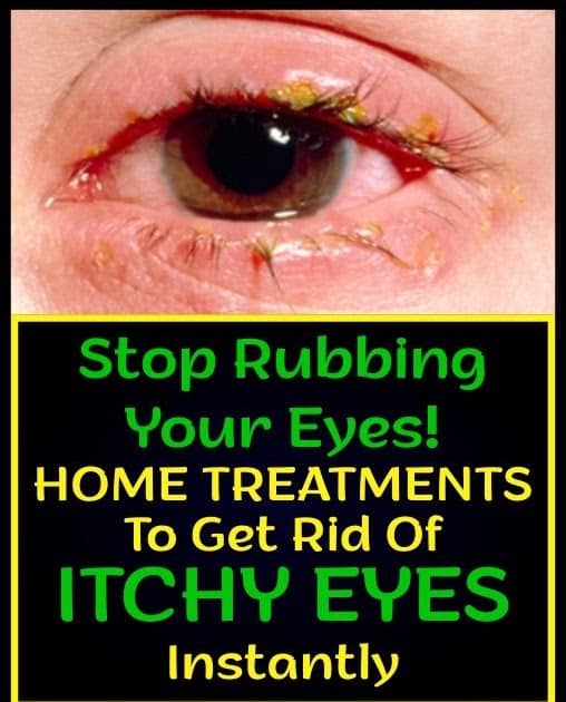 What To Do For Itchy Allergy Eyes