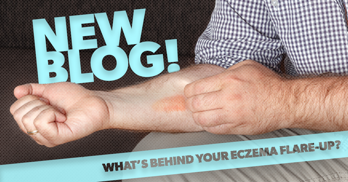 Whatâs behind your eczema flare