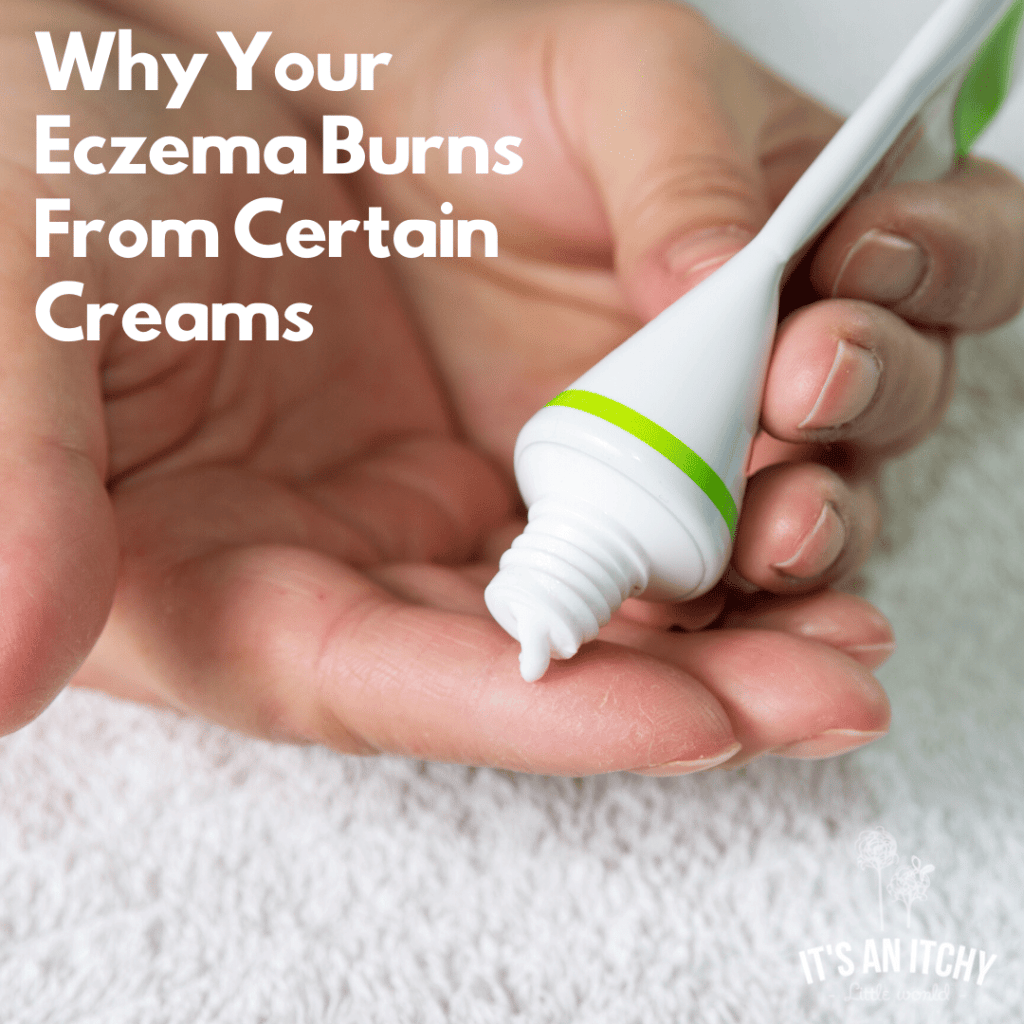 Why Your Eczema Burns From Certain Creams