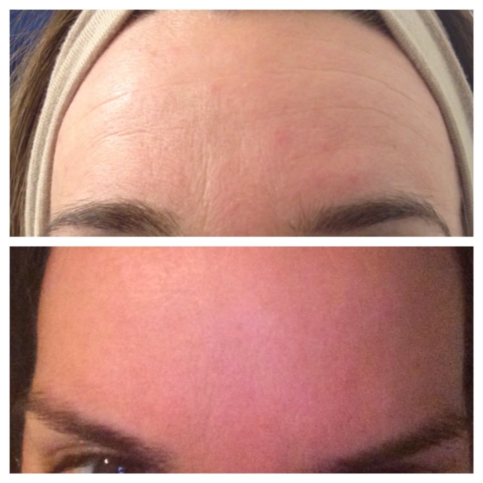 Wrinkles? Dark Spots? Acne? Eczema? I Can Help!!!!